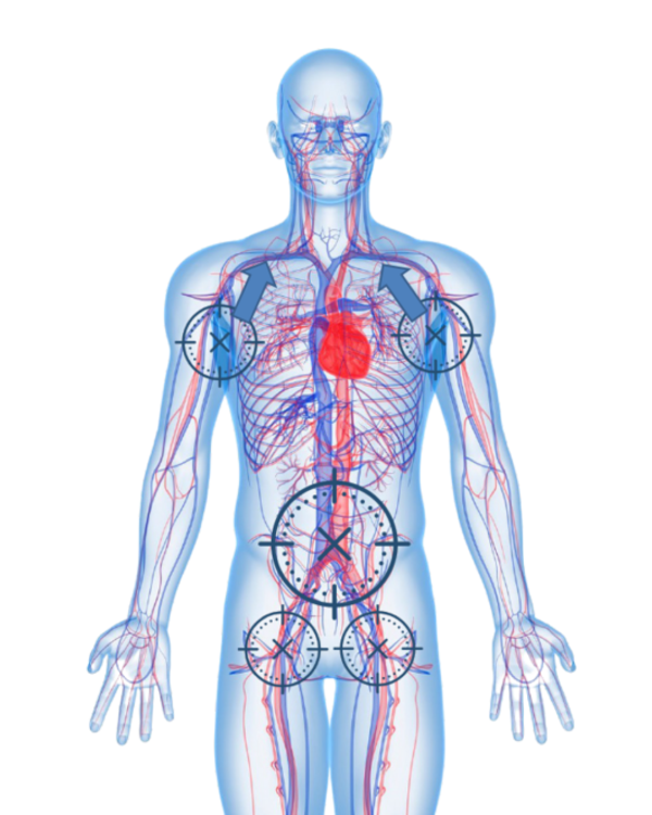 AAJT-S pas do ucisku aorty