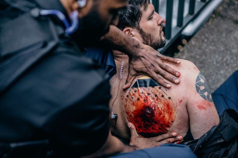 Opatrunek Sam Chest Seal wentylowy